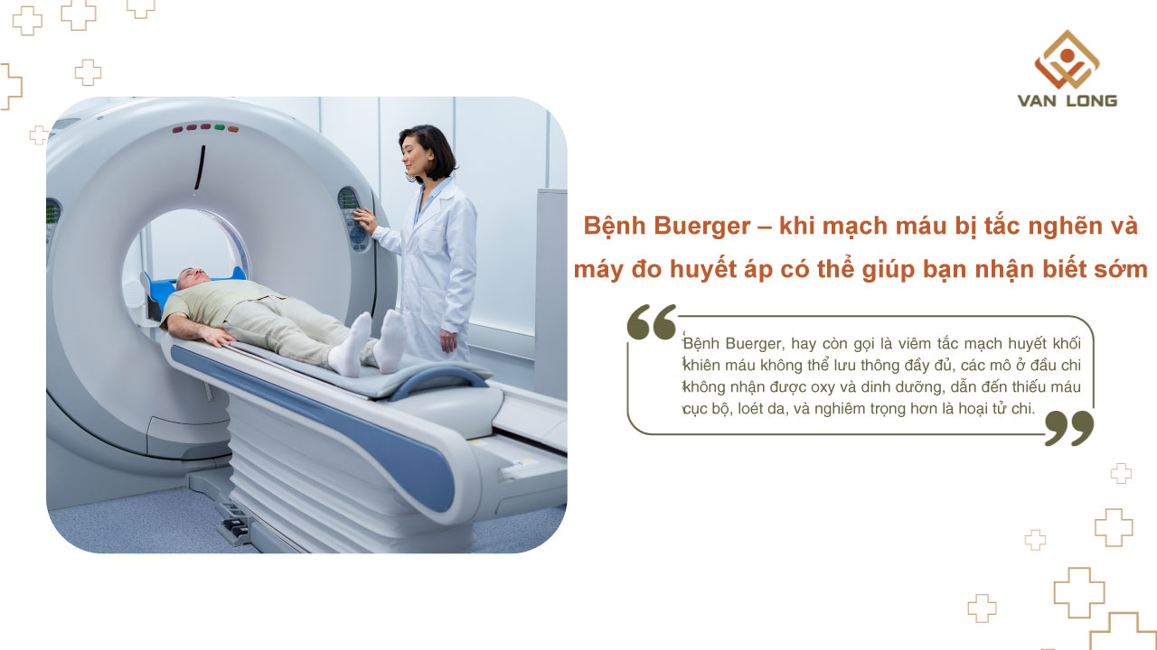Bệnh Buerger – khi mạch máu bị tắc nghẽn và máy đo huyết áp có thể giúp bạn nhận biết sớm