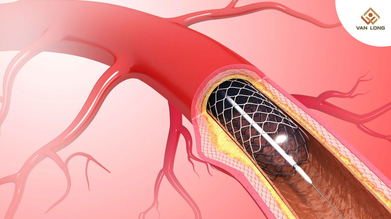 Phương pháp chẩn đoán và điều trị