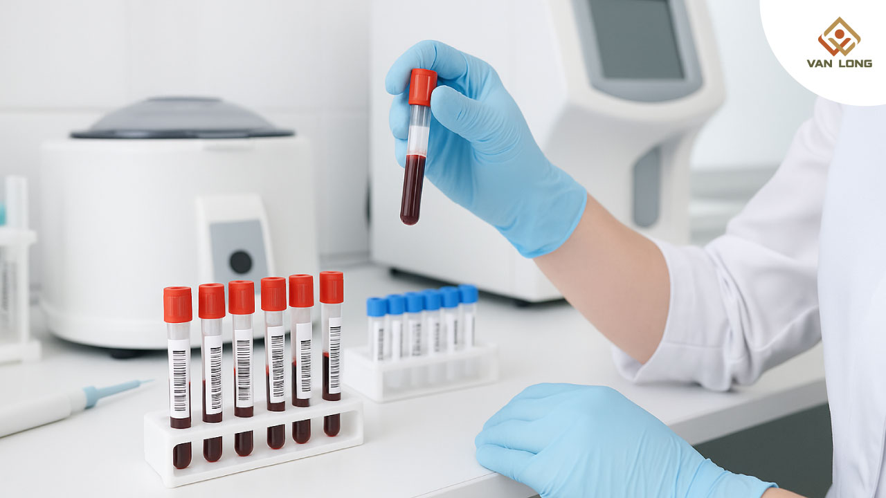 Đường huyết bất thường nhưng không phải tiểu đường – có thể do tuyến giáp