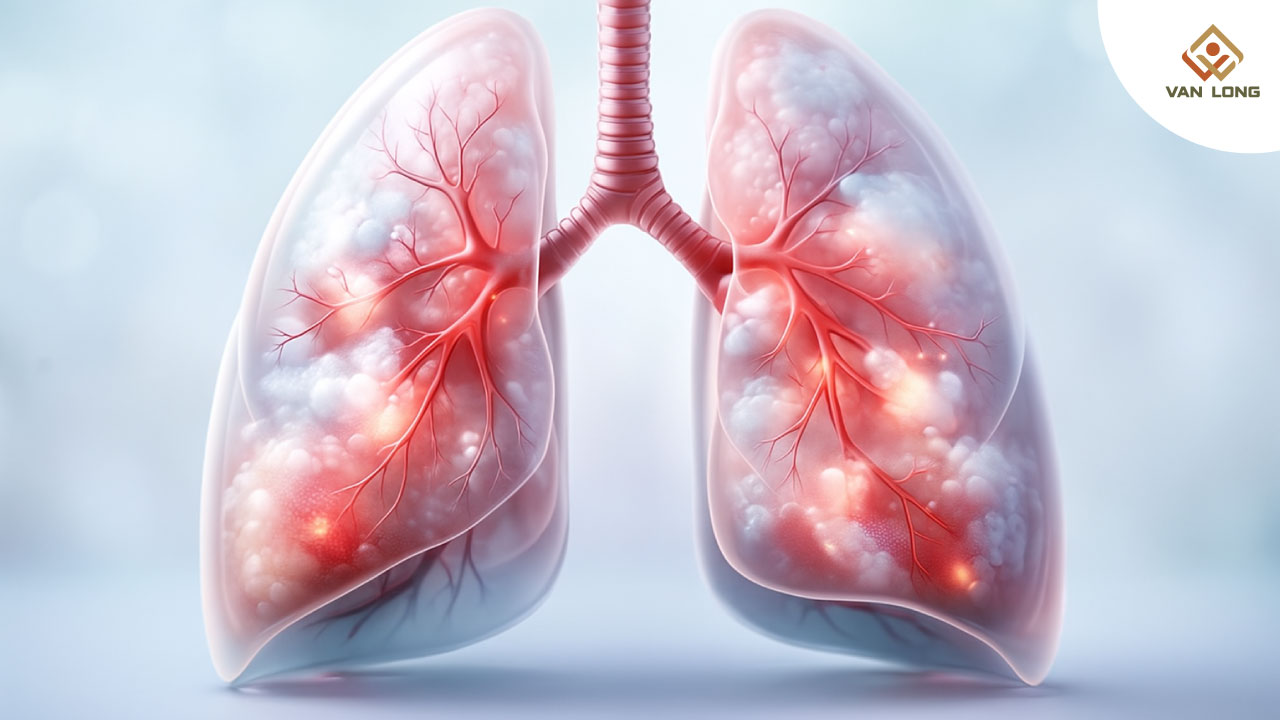 Những bệnh lý nguy hiểm có thể liên quan đến thân nhiệt dưới 36°C