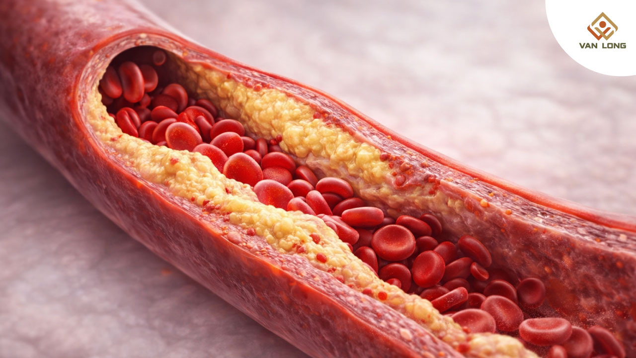 Năm tình huống bác sĩ lo ngại dù huyết áp “bình thường”