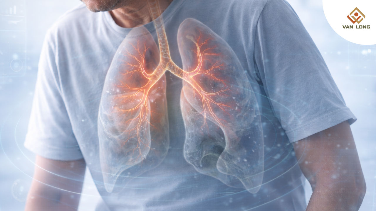  Tổng quan ngắn gọn về các giai đoạn của COPD